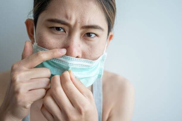 Masker membuat kulit wajah rentan berjerawat