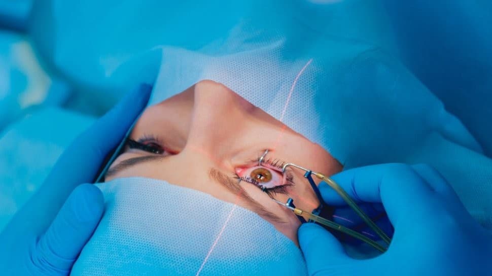 Ilustrasi operasi lasik