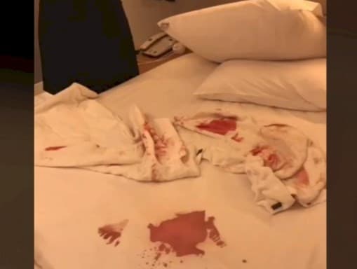 Curhatan seorang resepsionis hotel mendadak viral. (Foto: Tiktok)