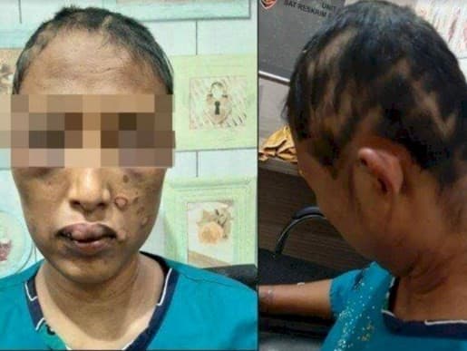 RN, wanita yang dianiaya suami di Banyuasin (Foto: Istimewa)