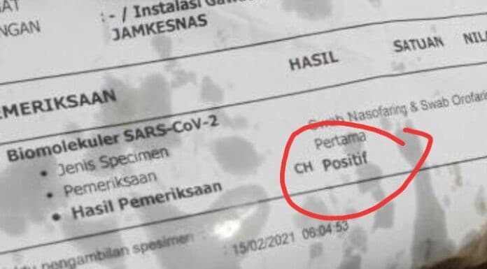netizen kaget beli gorengan pembungkusnya tes swab PCR dengan hasil positif (Foto:@infodepok_id )