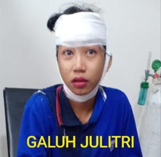 Ibu muda di Tangerang jadi korban begal saat membonceng anaknya (Foto: Polrestro Tangerang)