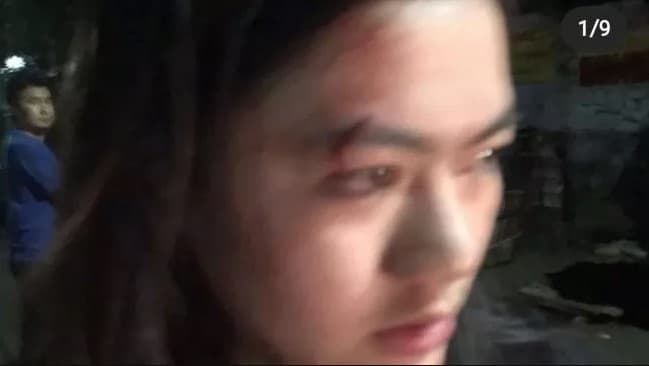 Penumpang wanita diduga dilecehkan dan dianiaya oknum driver GrabCar. (Foto: Instagram)