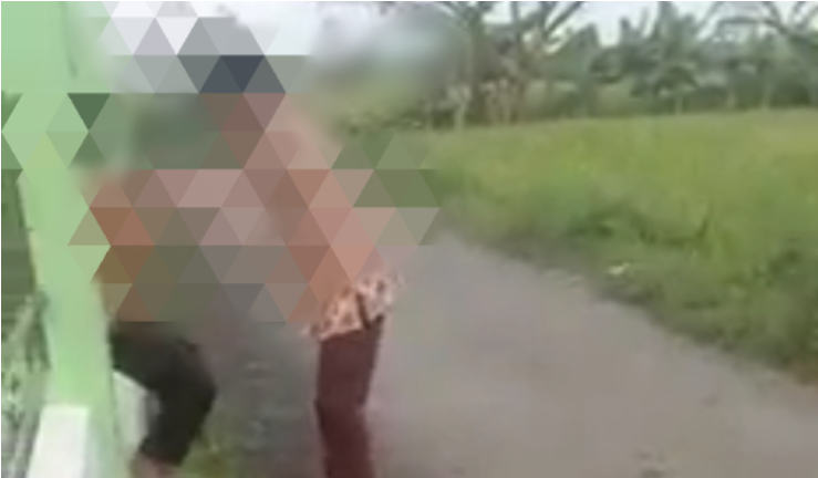 Bocah 9 tahun di Brebes jadi korban bullying temannya (Foto:Istimewa)