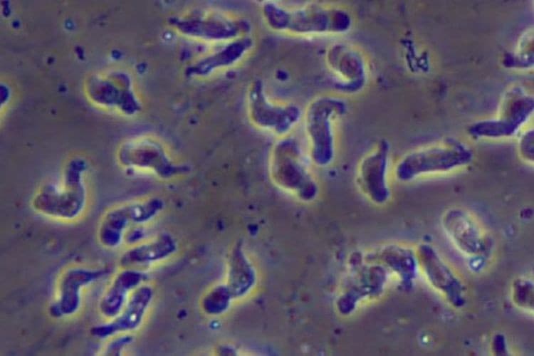 Ilustrasi amoeba (foto:Istimewa)