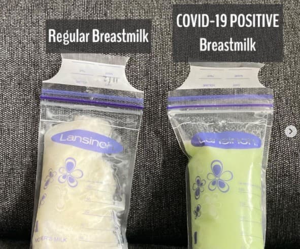 Heboh ASI Wanita Berubah Warna Jadi Hijau Neon Usai Positif Covid-19, Berbahayakah Buat Bayi?