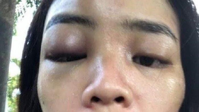 Polisi Kabulkan Penangguhan Penahanan Korban KDRT Neira yang Dilaporkan Suami soal Ilegal Akses