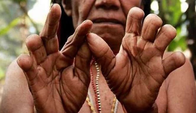 Tradisi Potong Jari Suku Dani (Foto: Istimewa)