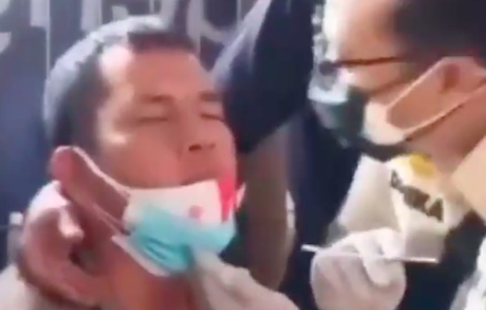Viral Video Petugas Cium Pria Saat Swab Test, Homo Atau?
