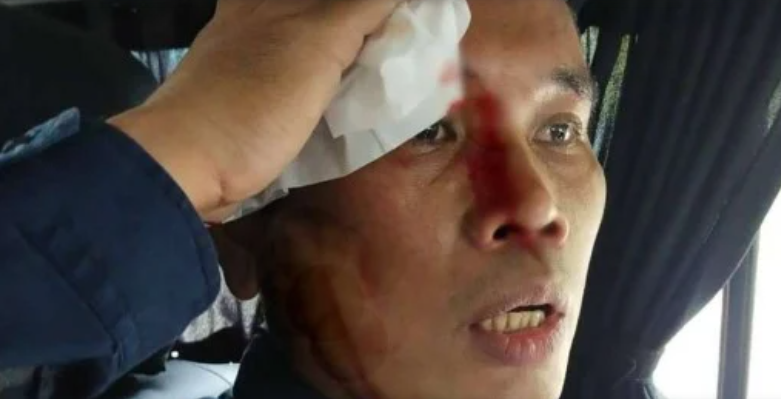 Demo Mahasiswa Ricuh, AKBP Ferikson Tampubolon terluka (Foto:Istimewa)