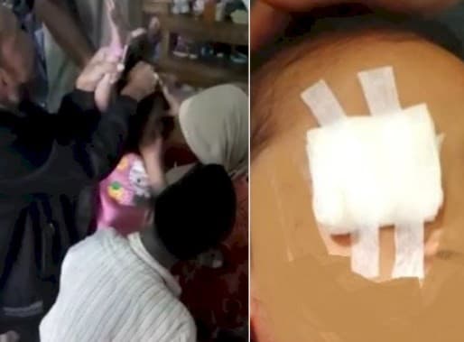 Mata bocah AP dicungkil ibunya sendiri untuk tumbal pesugihan ilmu hitam. (Foto: Istimewa)