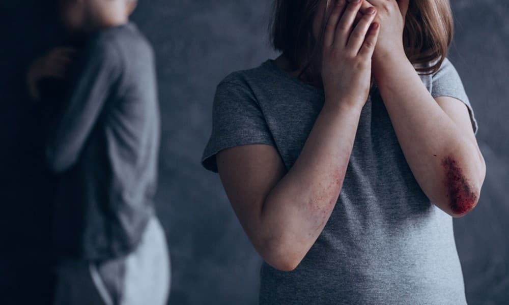 Ilustrasi Kekerasan Anak (Foto: Istimewa)