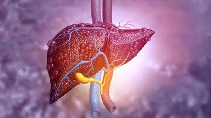 Ilustrasi hepatitis
