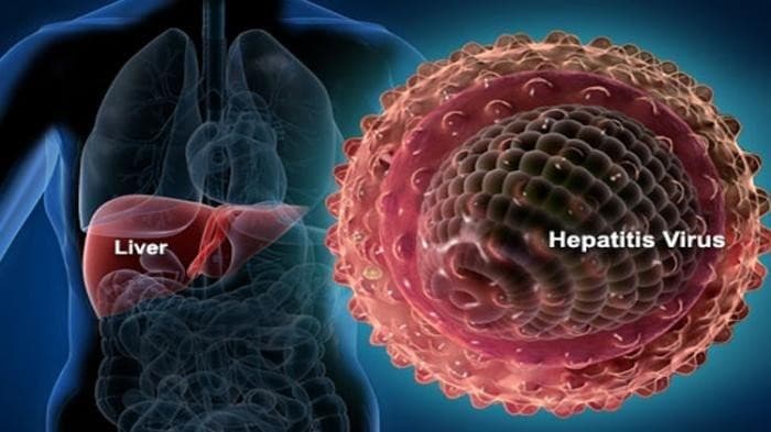 Hepatitis (ilustrasi)