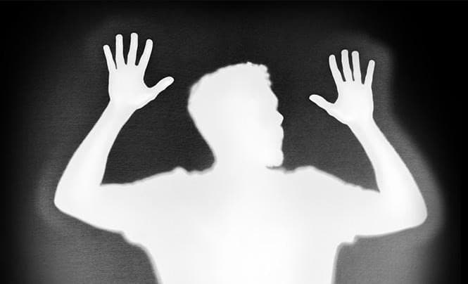 Update Kasus Pelecehan dan Bullying, KPI Tolak Biayai Pengobatan Psikiater Korban MS