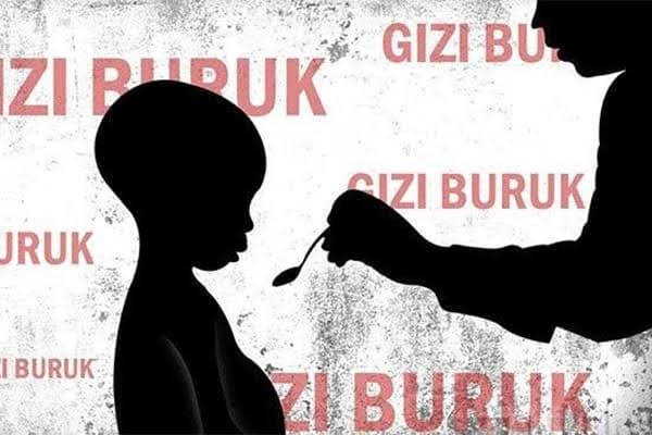 Gambar ilustrasi  stunting