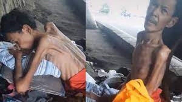 Seorang pria paruh baya tidur di kolong jembatan dengan tubuh seperti tengkorak dan sakit (Foto:Istimewa)