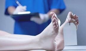 Polri Akan Serahkan Hasil Autopsi ke Keluarga Brigadir J Hari Ini