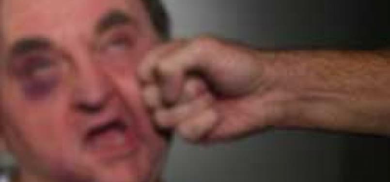 Usai Tantang TNI, Pria Ini Minta Maaf dengan Wajah Benjut Ancur! Diapain Tuh?