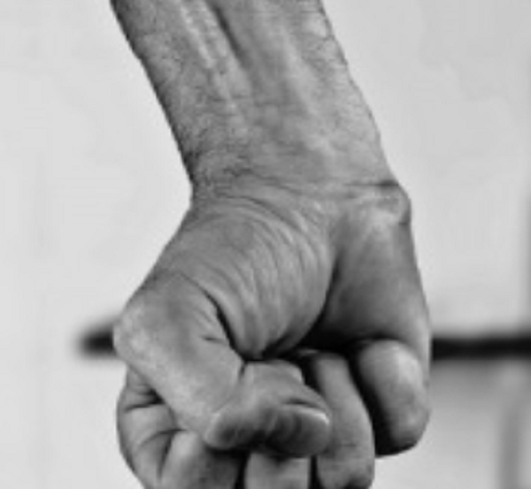 Ilustrasi pemukulan (Foto:Istimewa)