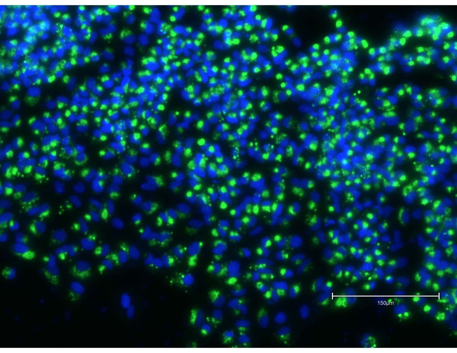 Ternyata Ini Virus Mematikan di Nigeria yang Buat Ratusan Orang Meninggal Dunia