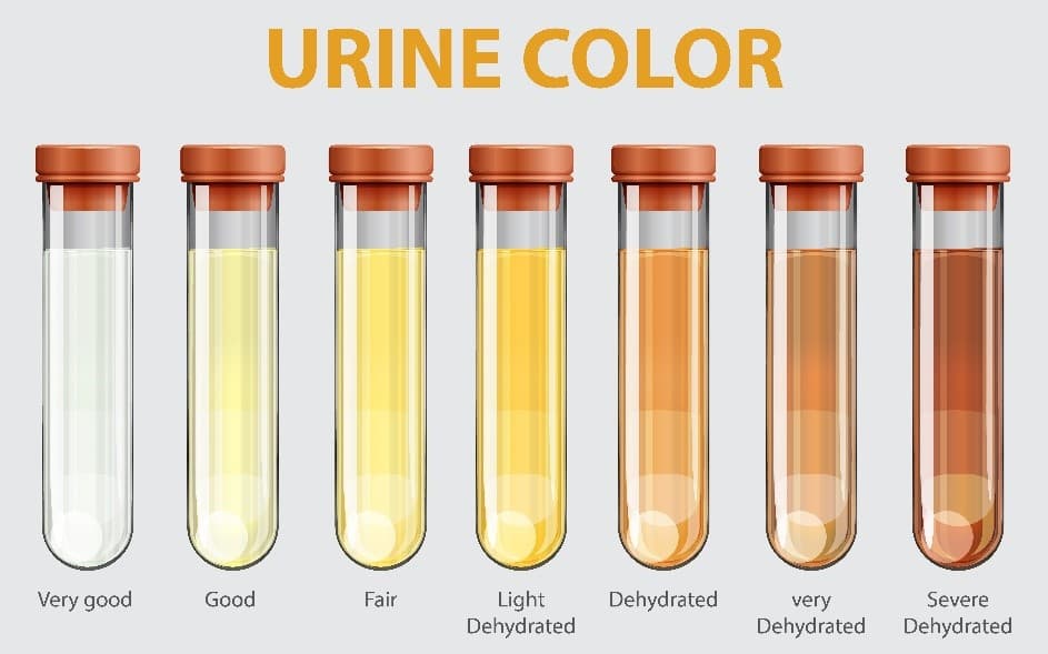 Warna Urine