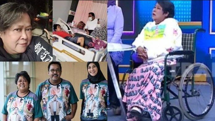Suti Karno terpaksa diamputasi kakinya karena diabetes.