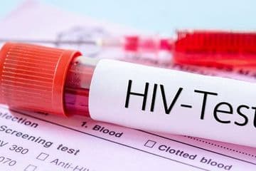 Ilustrasi HIV (Foto:Istimewa)