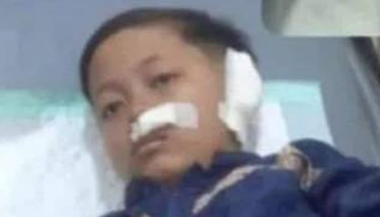 Balita 2 Tahun di Garut Jadi Korban Penganiayaan hingga Retak Tulang