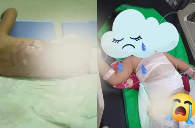 Viral balita tercebur ke panci kuah panas. (Foto: Z Creators/Ahmad Fauzy)