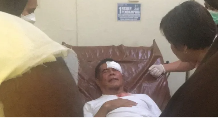 Terluka Kericuhan Iringan Jenazah Lukas Enembe, Pj Gubernur Papua Akan Dibawa ke RSPAD Jakarta