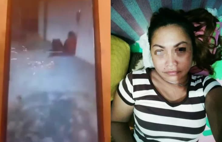 Tampang wanita yang viral lempari petasan ke ODGJ. (Foto: X)