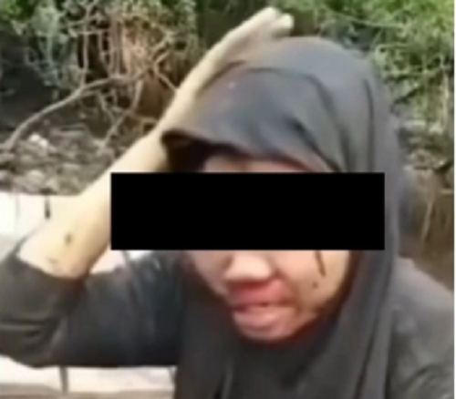 Santriwati babak belur melawaan saat akan dilecehkan orang tak dikenal (Foto:Istimewa)