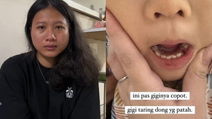 Terjadi Lagi Pengasuh Aniaya Anak Balita Majikan, Korban Dipukuli hingga Dibenturkan ke Pintu Kamar Mandi