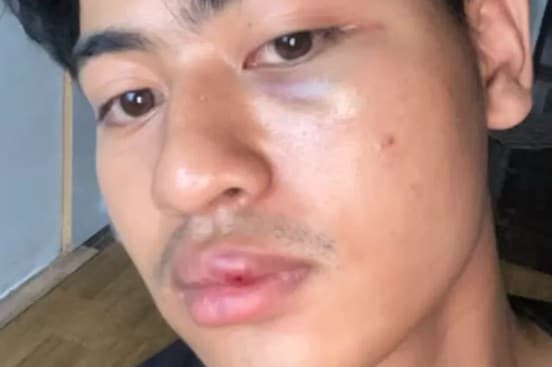 Viral Selebgram Hilmi Albaraq Diduga Dianiaya Karyawan Kafe Jabarano Coffee Milik Ridwan Kamil. (Foto: @hilmi_187)