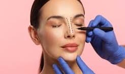 Ilustrasi Rhinoplasty (Foto:Istimewa)