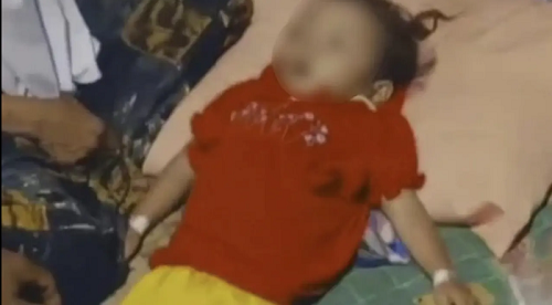 Begini Penjelasan Kemenkes dan RS soal Bocah Raya yang Meninggal karena Cacingan Akut