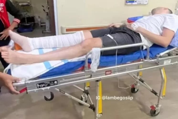 Turis Mesir Gugat Novotel Lombok Gegara Digigit Ular Berbisa. (Foto: Instagram)