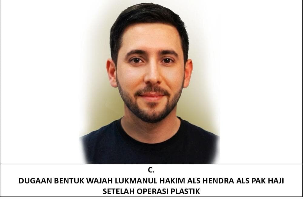 Sketsa wajah buron narkoba jaringan The Doctor Lukmanul Hakim usai diduga operasi plastik (Foto:Istimewa)