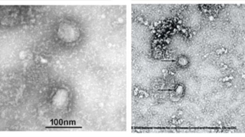 Virus Corona (Foto: Institut Mikrobiologi di Akademi Ilmu Pengetahuan Cina ) Virus Corona (Foto: Institut Mikrobiologi di Akademi Ilmu Pengetahuan Cina )