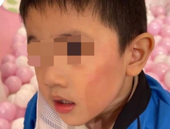 Seorang anak ditampar ibu-ibu di Mall Pontianak (Foto: Instagram) Seorang anak ditampar ibu-ibu di Mall Pontianak (Foto: Instagram)