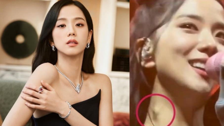 Benjolan di leher Jisoo BLACKPINK bikin fans khawatir. Benjolan di leher Jisoo BLACKPINK bikin fans khawatir.