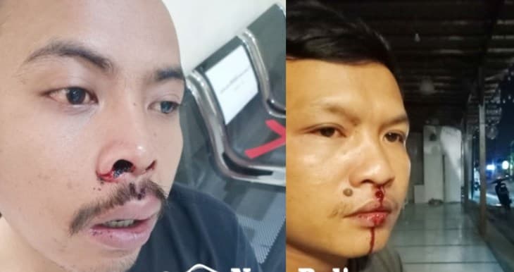 Staf Pepino Bali dihajar bule gegara pizza Rp 30 ribu. Staf Pepino Bali dihajar bule gegara pizza Rp 30 ribu.