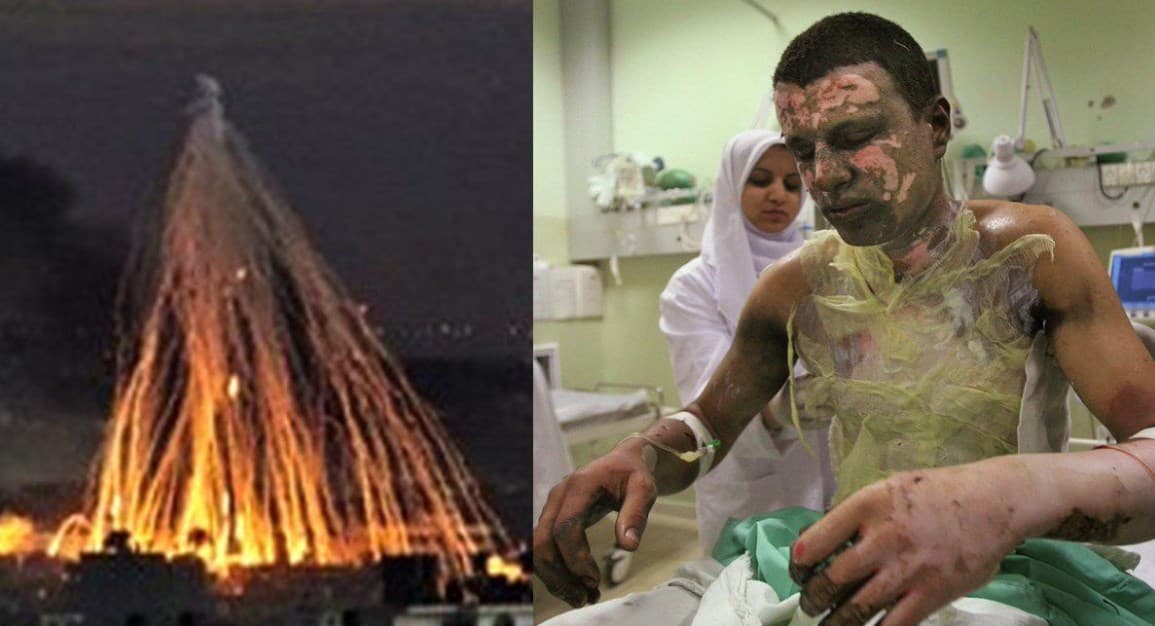 Ngerinya efek bom fosfor yang digunakan Israel untuk serang Palestina. Ngerinya efek bom fosfor yang digunakan Israel untuk serang Palestina.