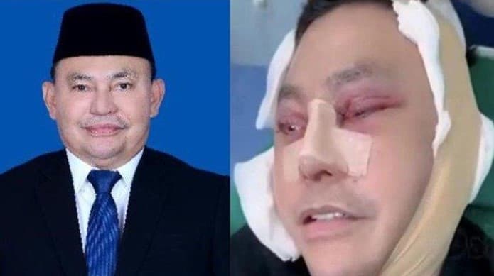 Anggota DPR Ujang Iskandar Ditangkap Atas Kasus Korupsi di Bandara Usai Operasi Plastik dari Vietnam. Anggota DPR Ujang Iskandar Ditangkap Atas Kasus Korupsi di Bandara Usai Operasi Plastik dari Vietnam.